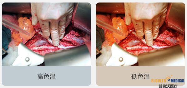 無影燈,手術(shù)燈,為他點(diǎn)贊