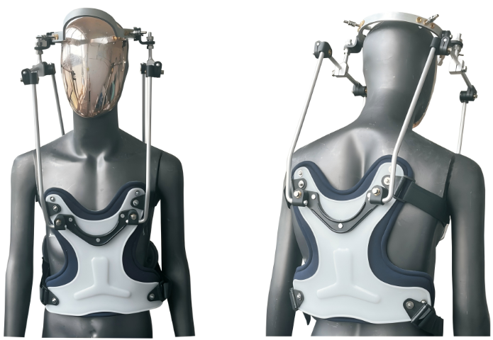 四川里昂矯形器價(jià)格 江蘇尚美醫(yī)療器械供應(yīng)