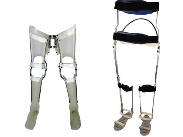 云南脊柱側(cè)彎矯形器大概多少錢(qián) 江蘇尚美醫(yī)療器械供應(yīng)