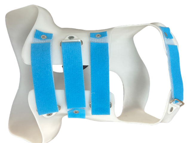 吉林頭部矯形器怎么樣 江蘇尚美醫(yī)療器械供應(yīng)