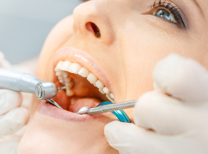 感應(yīng)加熱器用于牙科工具金屬與塑料的粘接