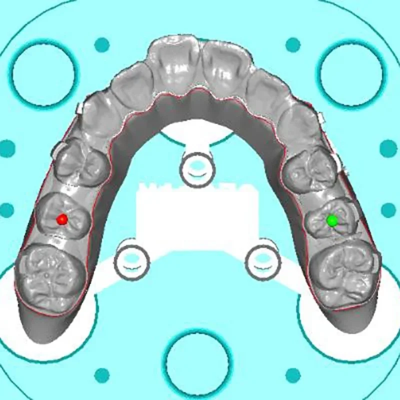 Precision Edge Finishing with HyperBrain Orthodontics Aligner Trimming ...
