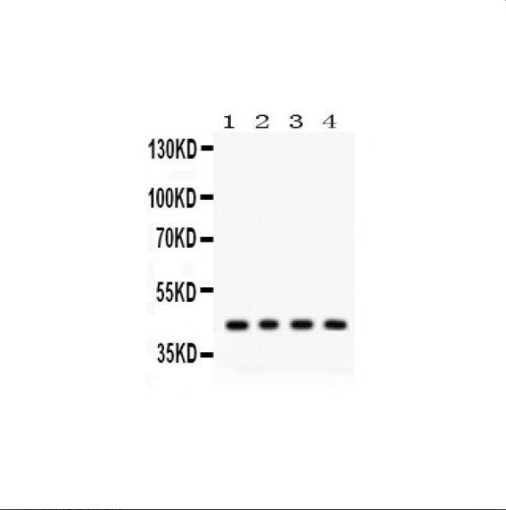 脂聯素受體1抗體