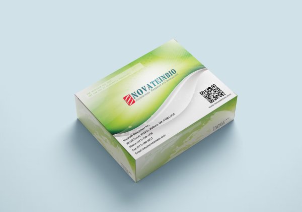 Human Complement 1Q C1q ELISA Kit