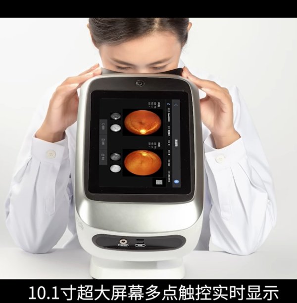 一鍵自拍 便攜式 免散瞳眼底照相機(jī)iFLASH-I