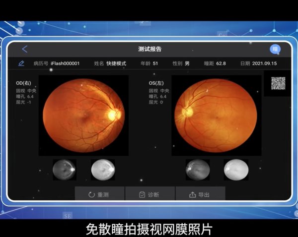 愛絡(luò)博 便攜式免散瞳眼底照相機(jī)iFLASH-I PLUS