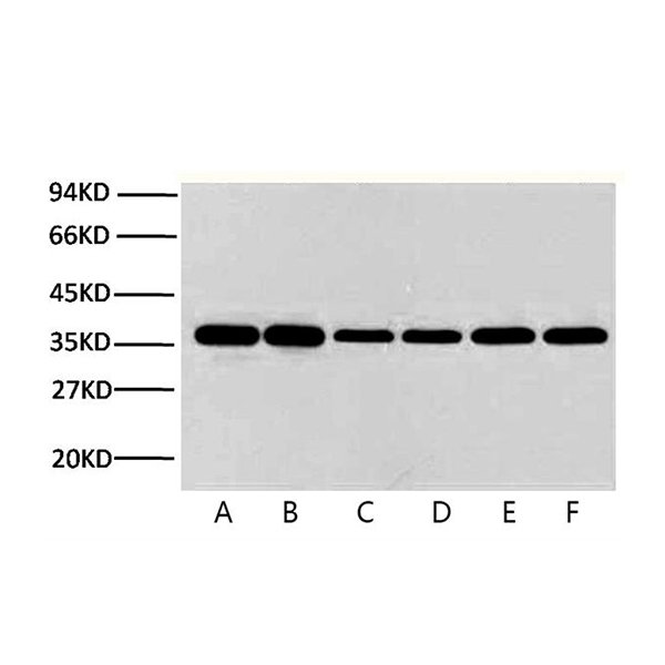 Western Blot