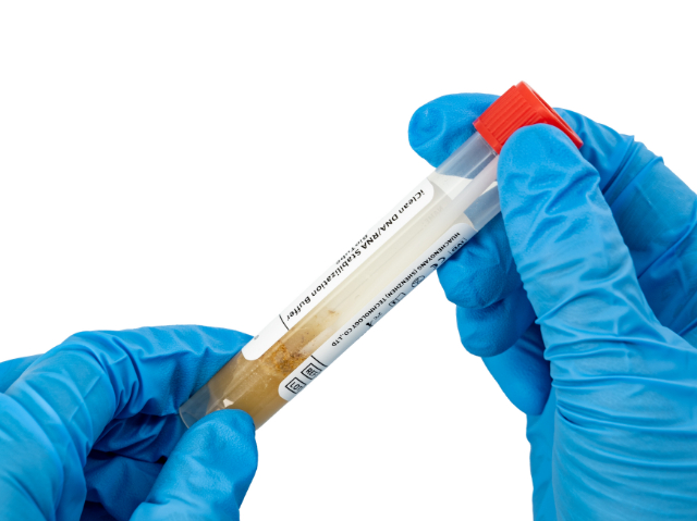 广州体检粪便采集器支持定制