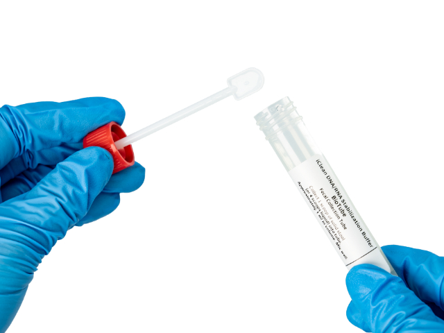 河北筛查粪便采集器检验容器