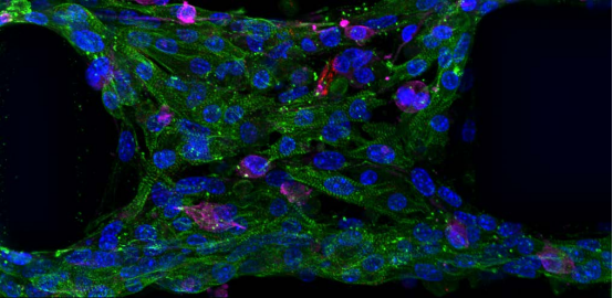 人類微心臟模型助力精細醫(yī)療與藥物研發(fā)