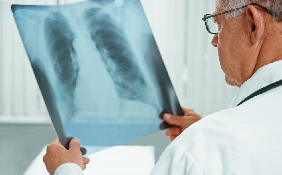 我國放射診斷技術(shù)的發(fā)展歷程