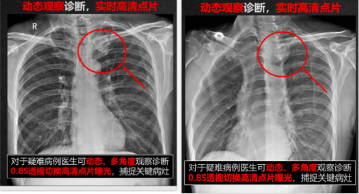 動態DR“真假難辨”？靜態DR即將謝幕？