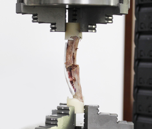 Torsion Test of Absorbable Rib Fixator - Changzhou XSPEED Testing ...