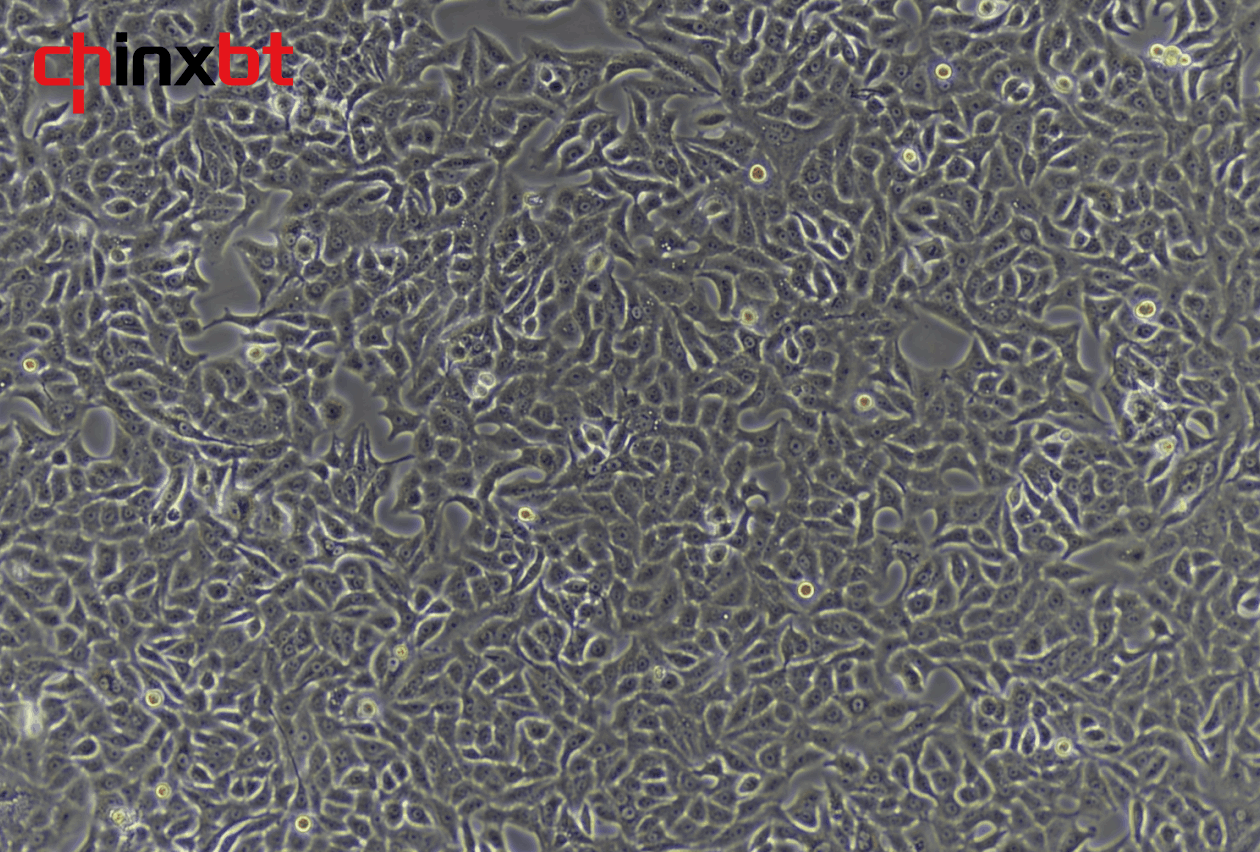 A549+RFP 人肺癌细胞+RFP_南京中欣博泰生物技术有限公司