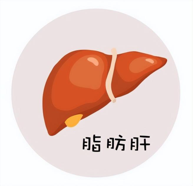 中年脂肪肝：基因檢測給運(yùn)動飲食方向