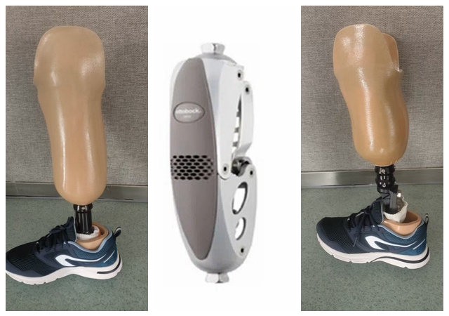 麗水假肢技術(shù)指導(dǎo) 信息推薦 赴健假肢矯形醫(yī)療科技供應(yīng)