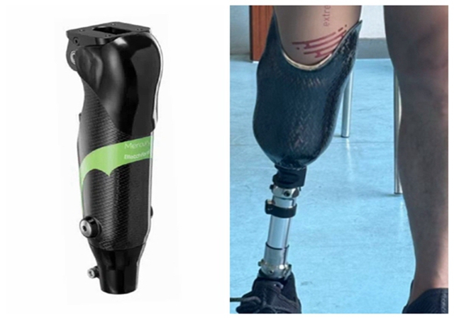 衡陽(yáng)假肢適配 信息推薦 赴健假肢矯形醫(yī)療科技供應(yīng)