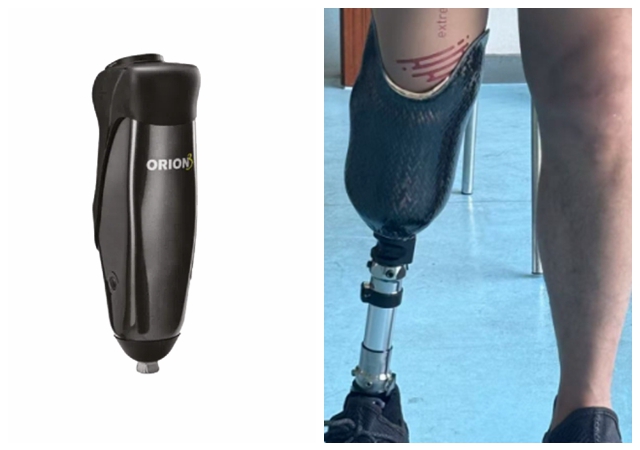 宿遷假肢工廠直銷 信息推薦 赴健假肢矯形醫(yī)療科技供應(yīng)