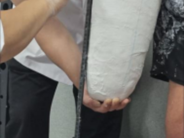 宁波芯片假肢价格