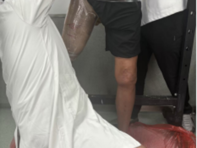 寧波芯片假肢供應商 信息推薦 赴健假肢矯形醫(yī)療科技供應