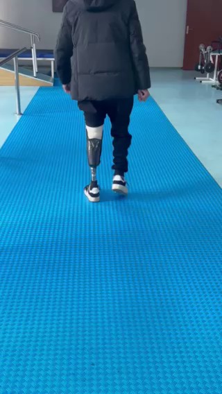 岳阳机械假肢,假肢