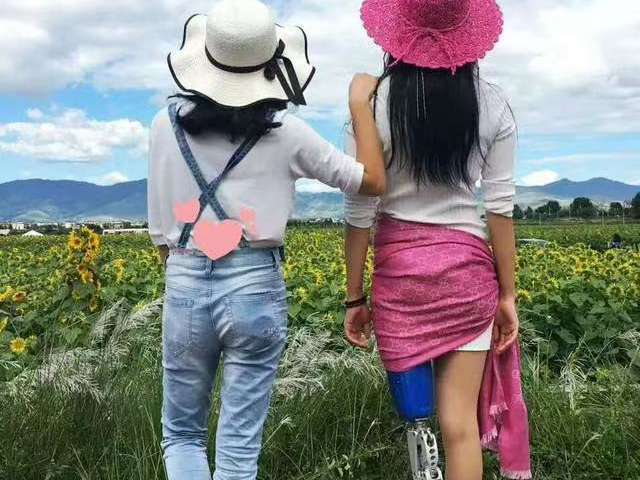 宁波机械假肢功能,假肢