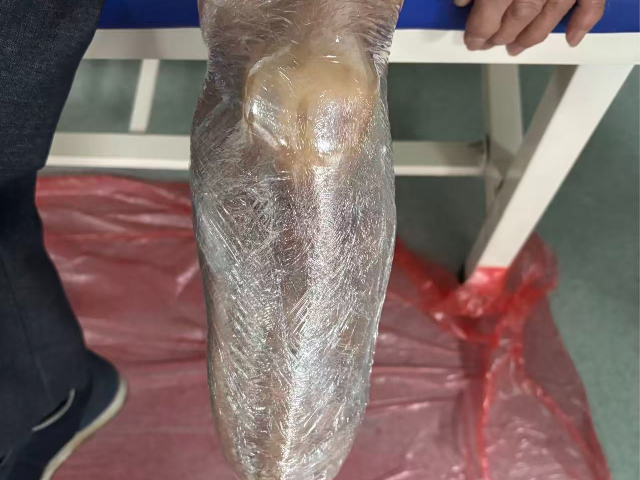 泰州英中耐假肢 信息推薦 赴健假肢矯形醫(yī)療科技供應(yīng)