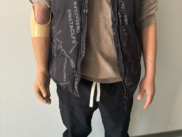 常州英中耐假肢 信息推薦 赴健假肢矯形醫(yī)療科技供應