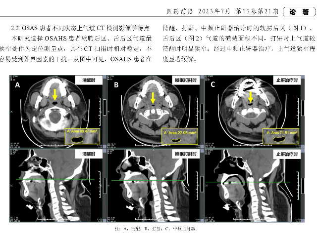 陕西在线中频电刺激睡眠呼吸治疗仪厂家报价