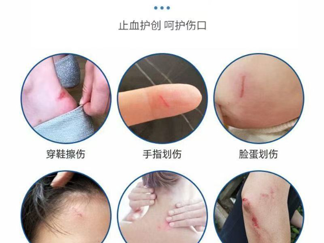 河南高彈創(chuàng)口貼銷售廠家