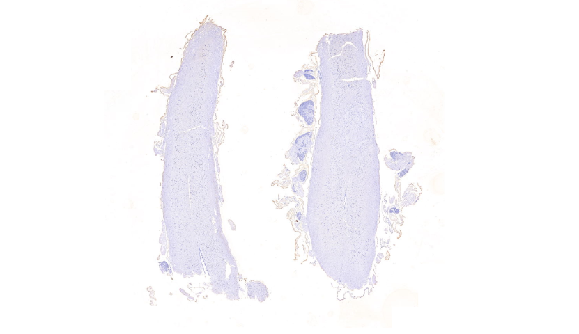 內(nèi)蒙古哪里有病理切片實(shí)驗(yàn)效果 南京有夢(mèng)生物科技供應(yīng)